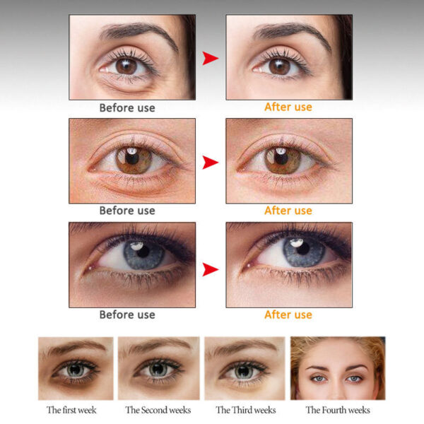 ARTISCARE Anti Eye cream - Image 3