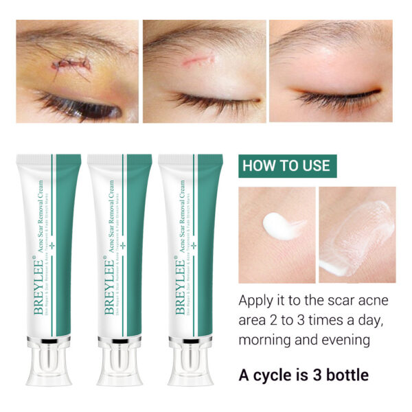 BREYLEE Cleansing Cream Soothing Problem Skin Gel Gel - Image 3