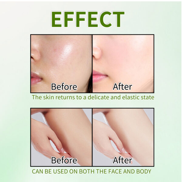 Exfoliating Gel 60g Deep Cleansing Pores Mild - Image 5