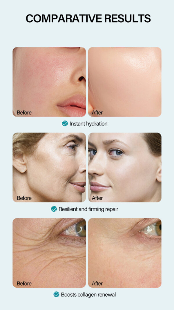 Anti-Wrinkle Face Cream Containing Hyaluronic Acid Hydrating High Moisturizing Fade French - Image 8
