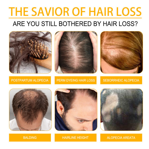 Hair Growth Repair Care Essential Oil - Image 6