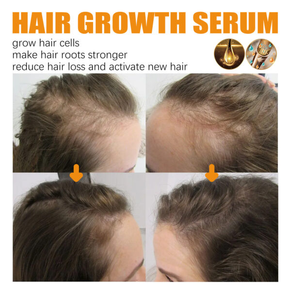 Hair Growth Repair Care Essential Oil - Image 4