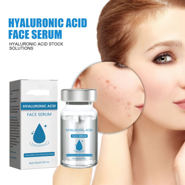 Hyaluronic Acid Replenishment - Image 7
