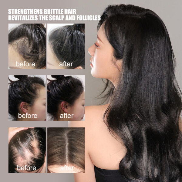 Hair Growth Repair Care Essential Oil - Image 2