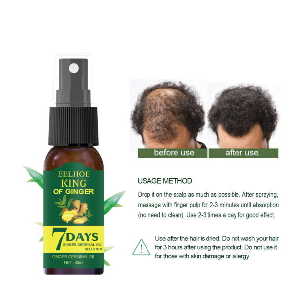 EELHOE Foreign Trade Cross-border Ginger Nutrition Spray Ginger Hair Root Spray Moisturizing Hair Hair Care Spray Spray - Image 4